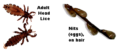 adult head lice & nits (eggs) on hair 